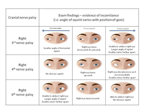 fbs medical meaning|fbs eyes.